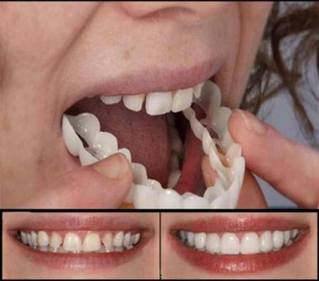 Membrane Teeth Whitening