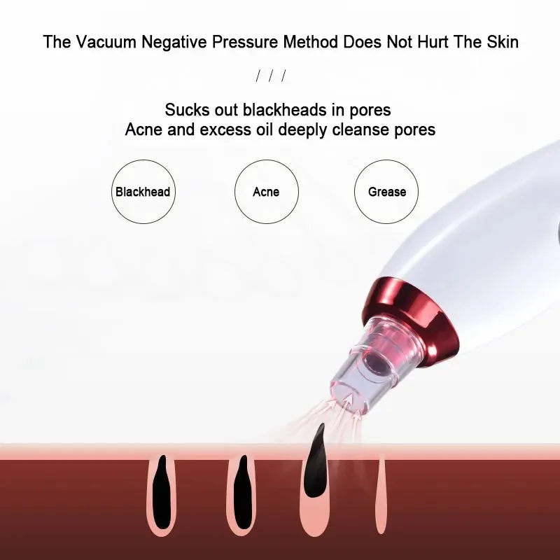 Blackhead Remover Device