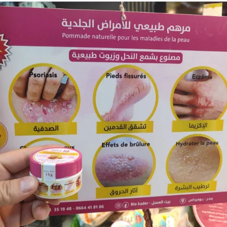 مرهم طبيعي للأمراض الجلدية