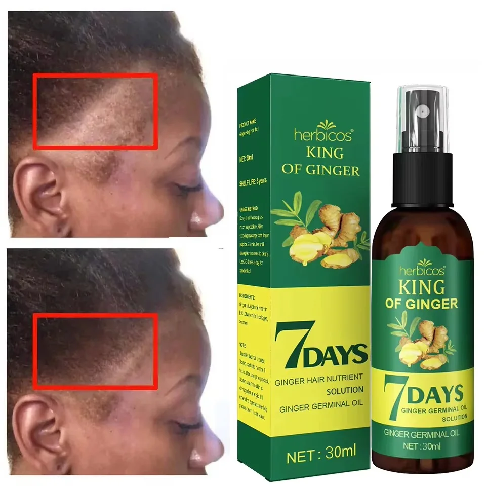 Spray du Gingembre 7days