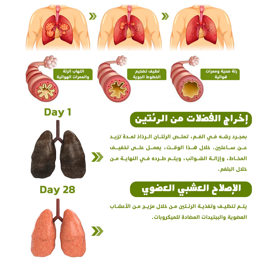 Natural Lung And Respiratory Support Spray