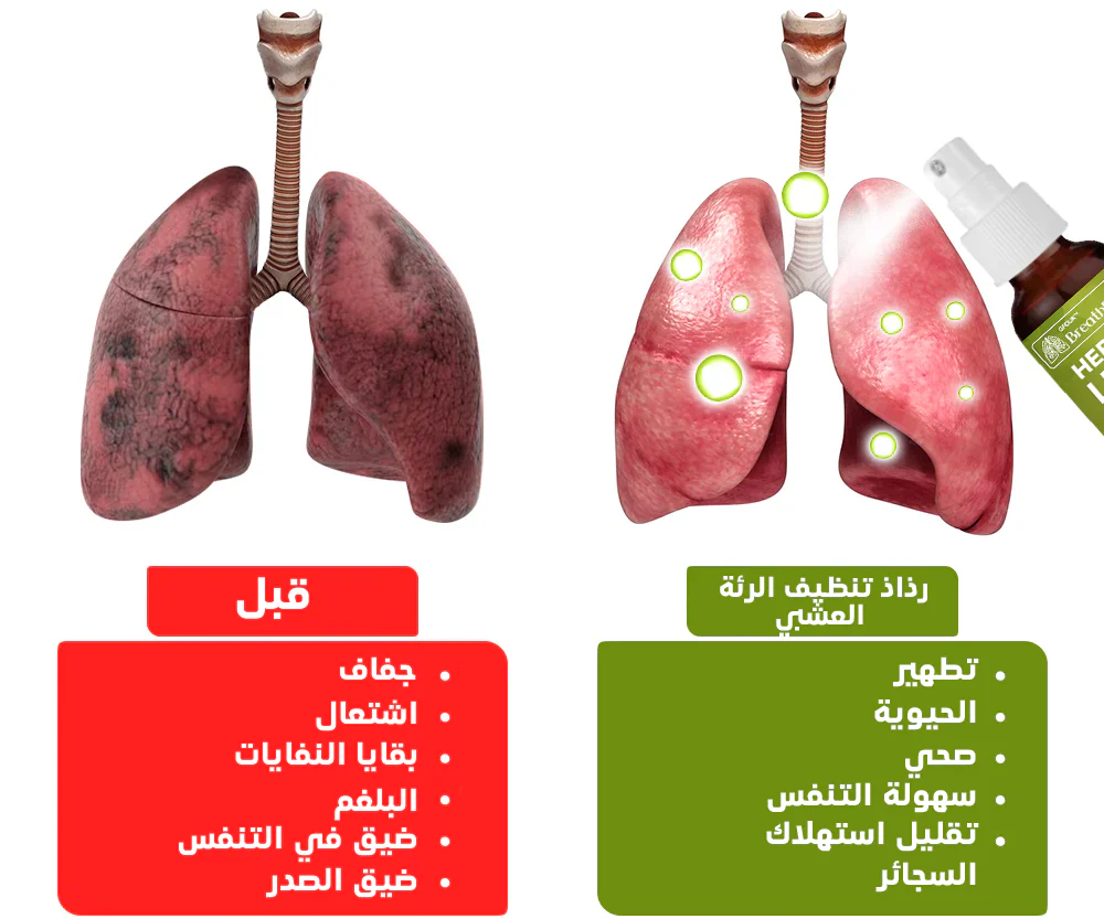 Natural Lung And Respiratory Support Spray