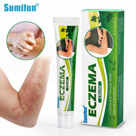 Eczema & Psoriasis Cream