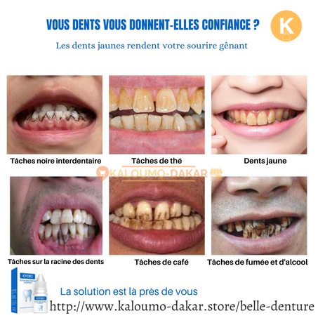 Liquide de blanchiment de dent