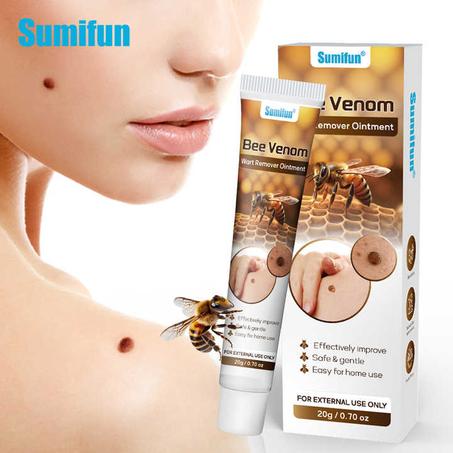 كريم سومفون العشبي لإزالة الثآليل بسرعة وأمان