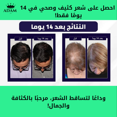 Spray de Croissance Capillaire