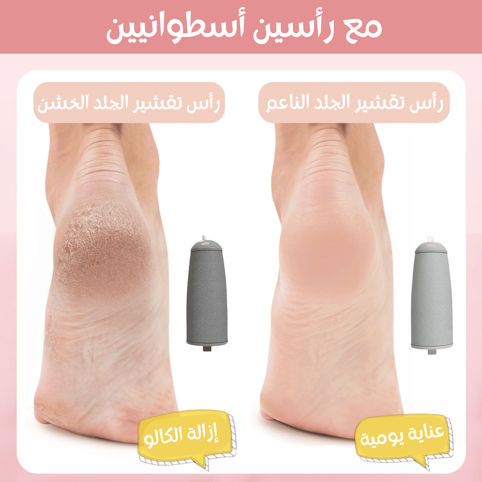 جهاز تقشير وتنعيم القدمين الأصلي  - القابل لإعادة الشحن