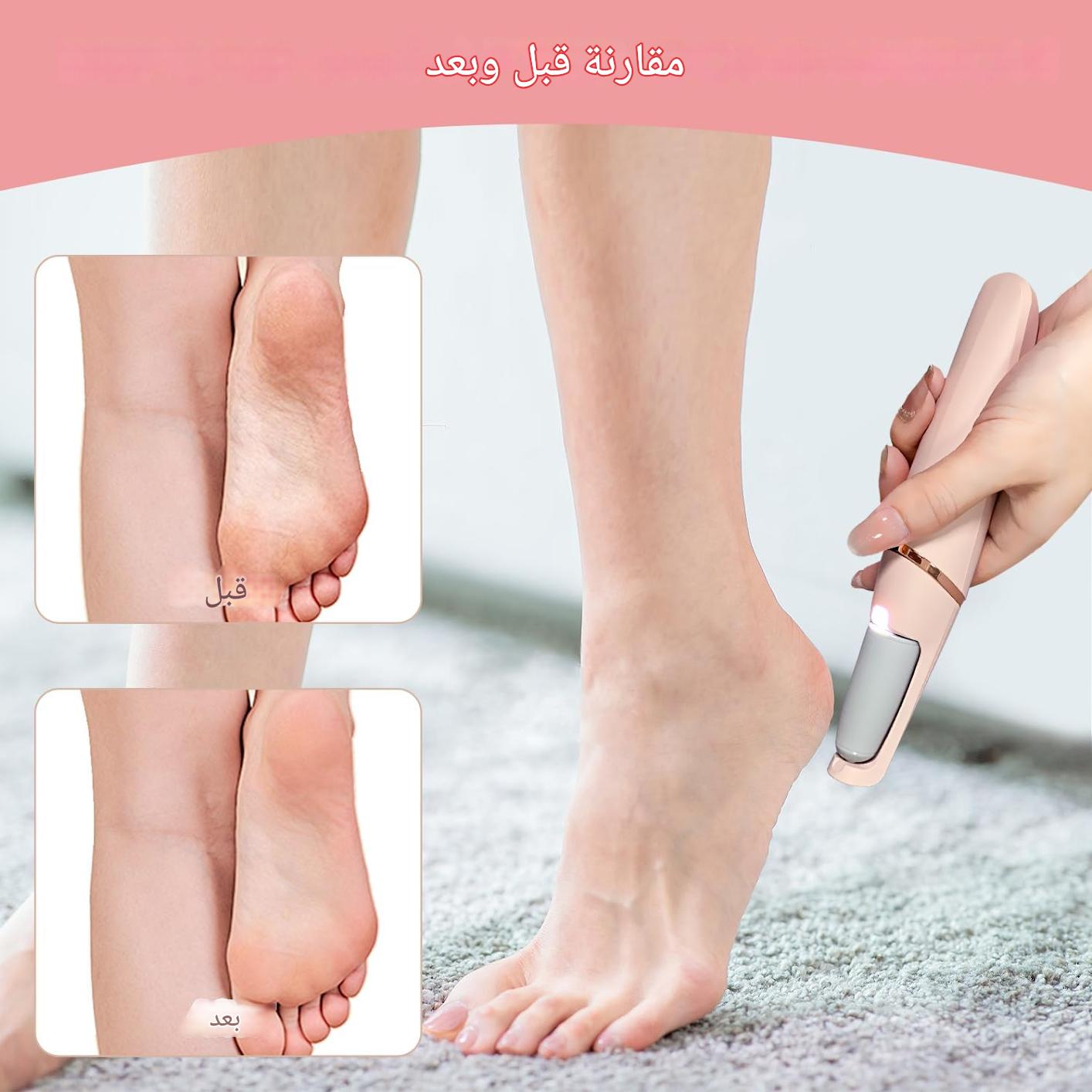 جهاز تقشير وتنعيم القدمين الأصلي  - القابل لإعادة الشحن