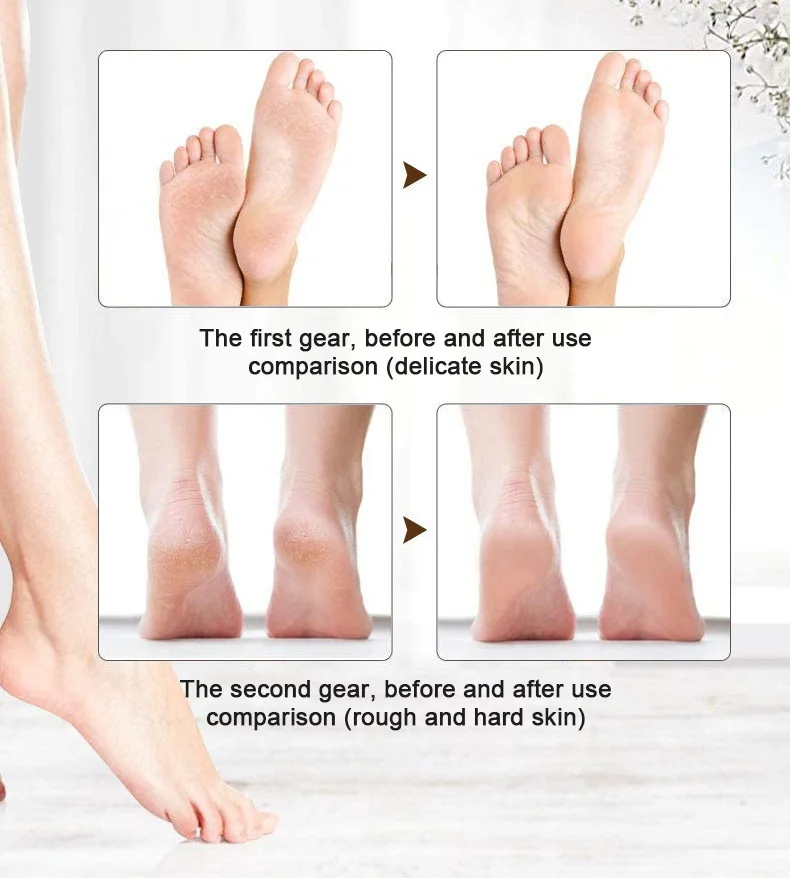 ELECTRIC PEDICURE DEVICE -UAE