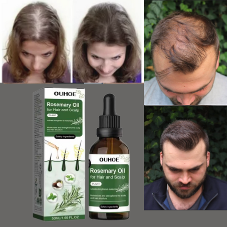 زيت إكليل الجبل لتساقط الشعر