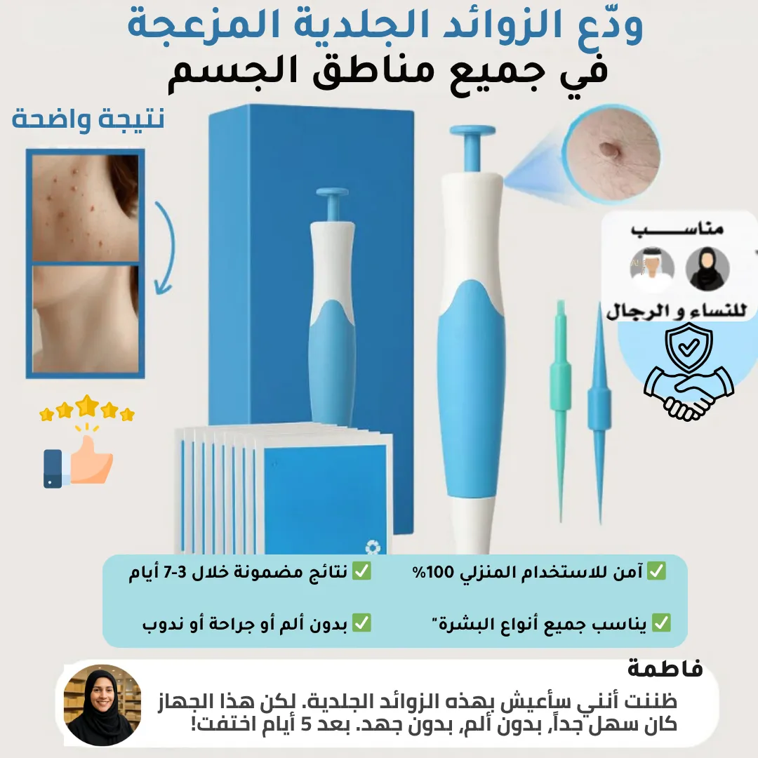 تخلّص من الزوايد الجلديّة بسهولة ومن بيتك!