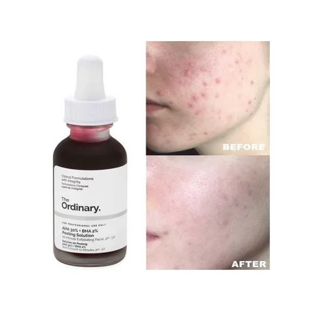 THE ORDINARY Solution de Peeling AHA 30% + BHA 2% Solution de Peeling