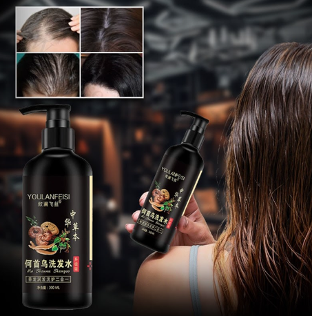 شامبو Black Hair Shampoo غطّي الشعر الأبيض في 5 دقائق فقط