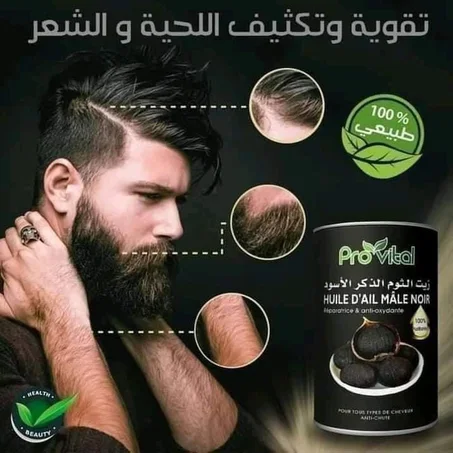 سك الثوم الاسود لعلاج الصلع