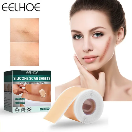 Silicone Scar Sheets™
