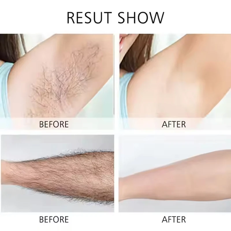 ماكينة حلاقة نسائية قابلة لإعادة الشحن