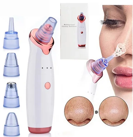 إزالة الرؤوس السوداء