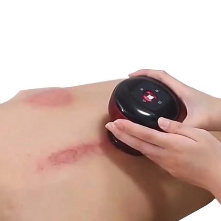 CUPPING THERAPY MASSAGER
