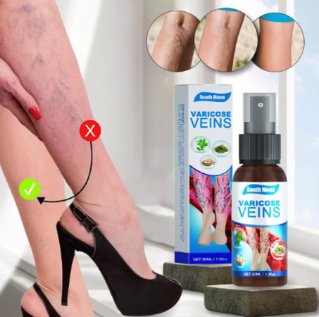 Varicose Teins Treatment Spray