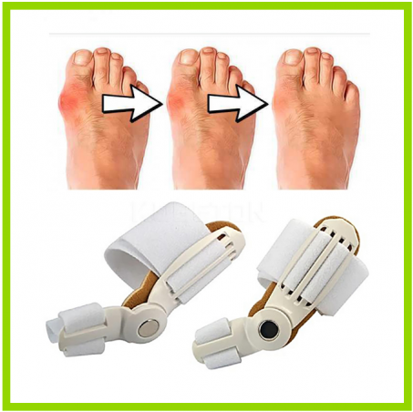 مصحح إعوجاج إصبع القدم الطبي