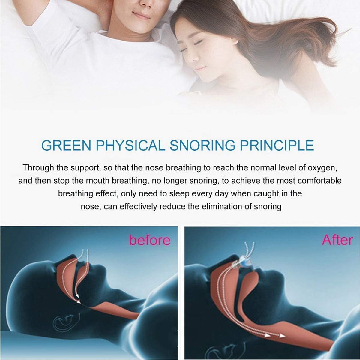 Anti Snoring Device