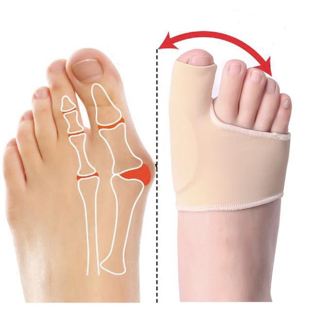Orthèse Hallux Valgus