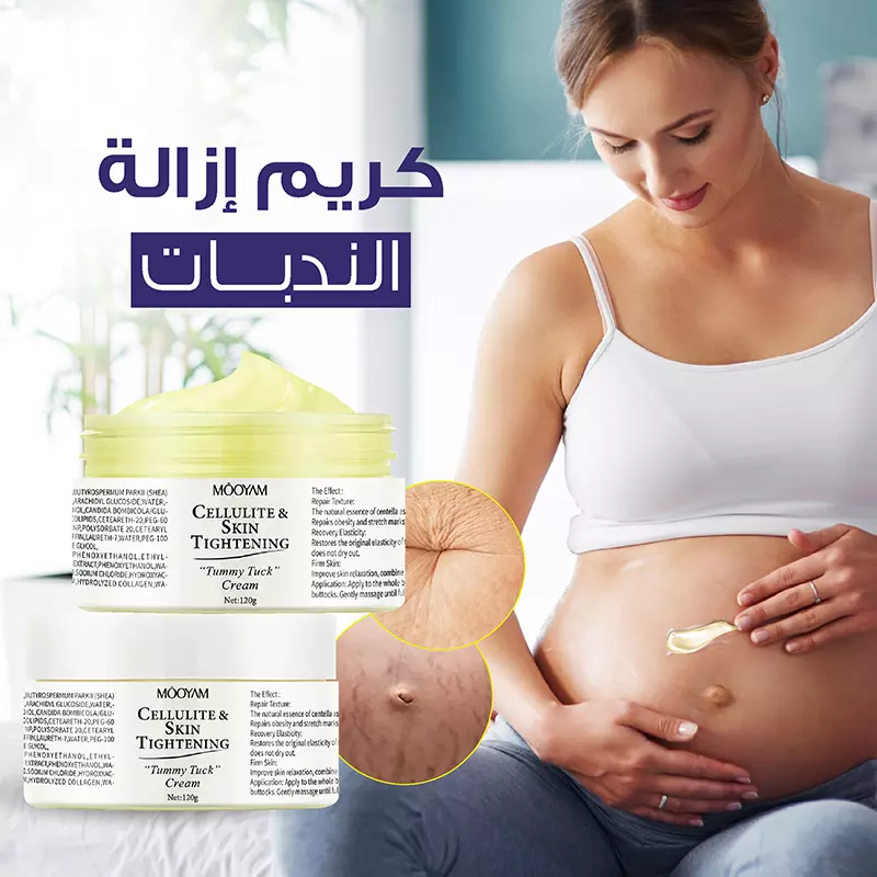 كريم إزالة الندبات