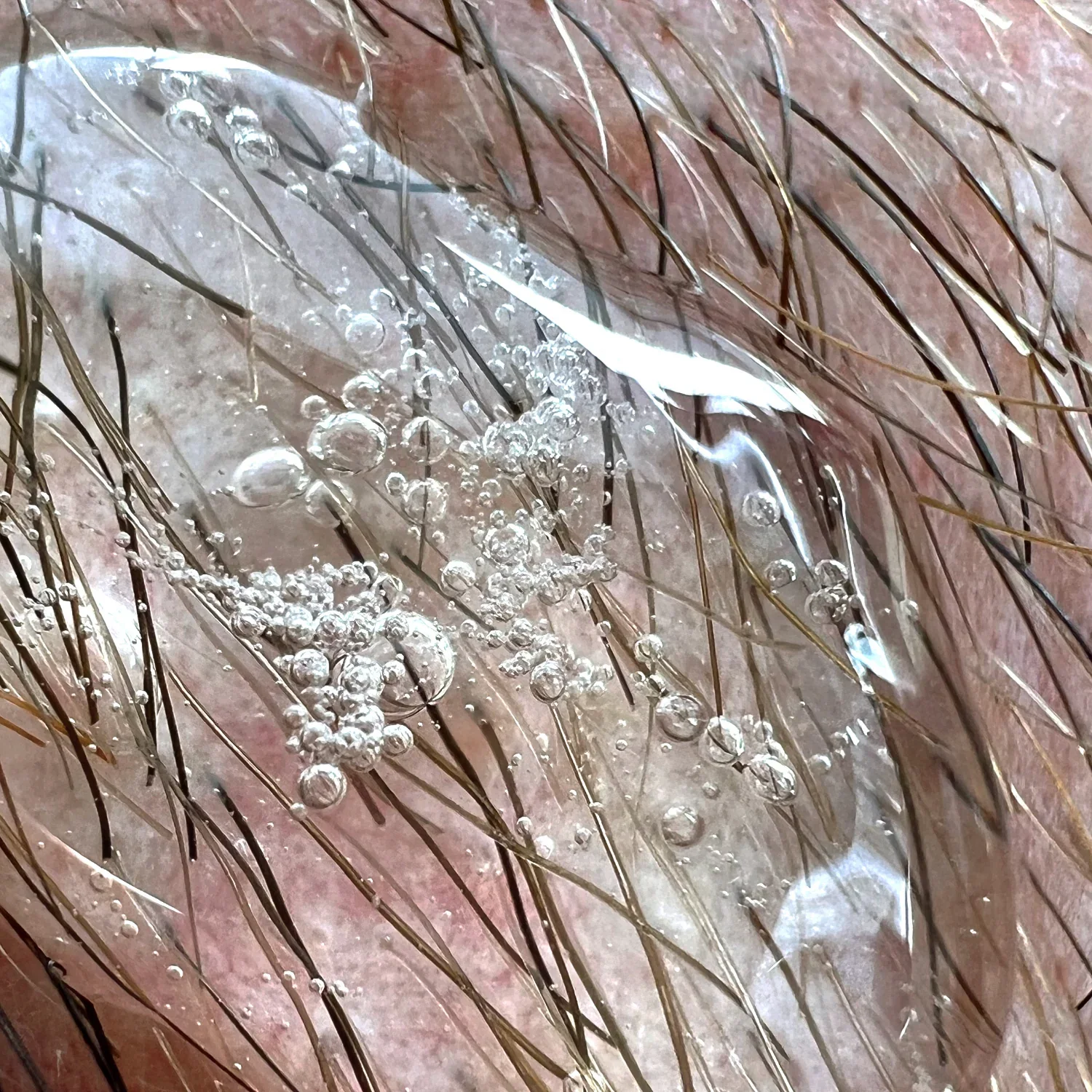 Beard & Hair Growth Kit