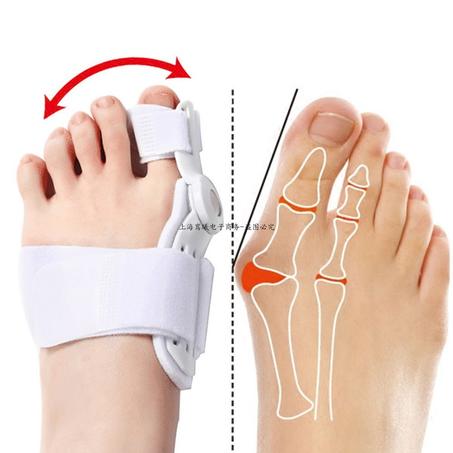 جهاز تصحيح أصبع القدم