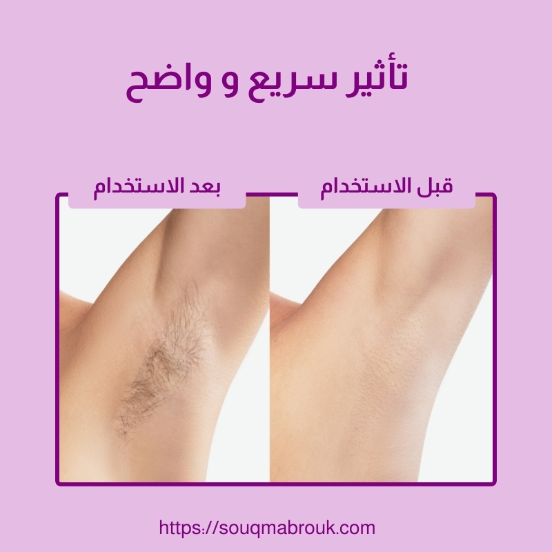 أداة إزالة الشعر الكريستالية