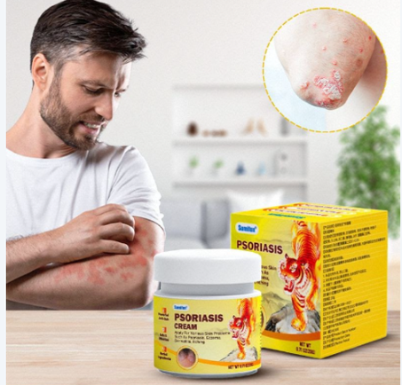 🐅 كريم الصدفية – Tiger Psoriasis Cream