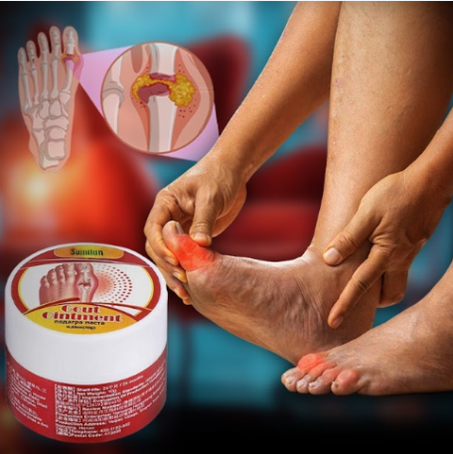 (10g)   كريم لعلاج النقرس