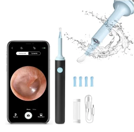 ودّع القلق داخل الأذن — منظف الأذن الذكي بكاميرا FHD وواي-فاي