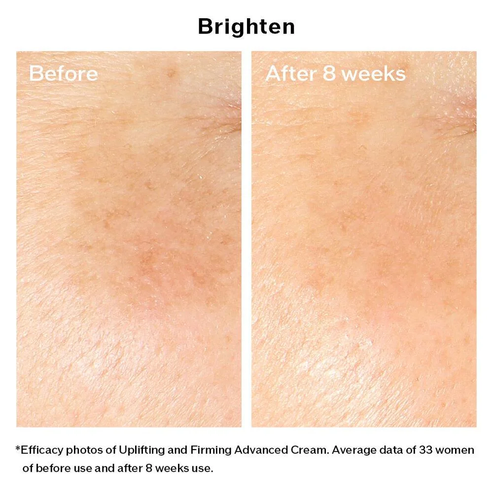مجموعة من شيسيدو لشد الوجه و جعلها اكثر تماسكاً VITAL PERFECTION SET FROM shiseido