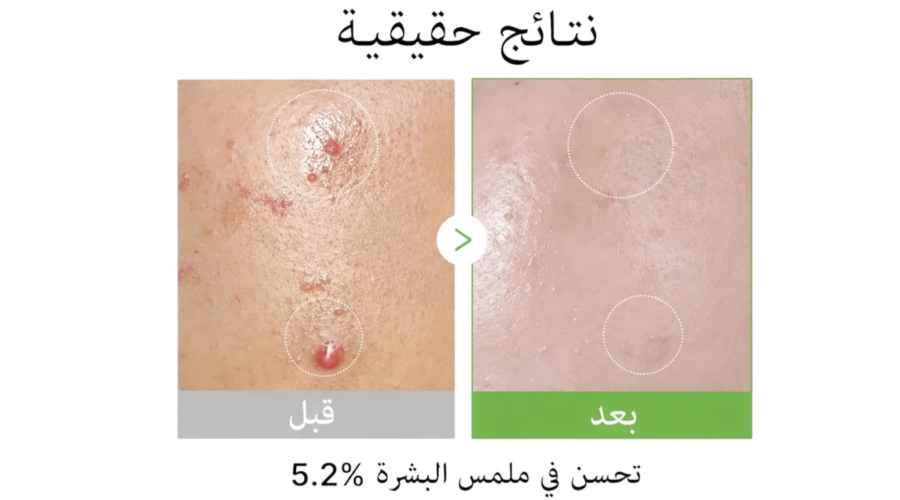 سيروم ميدكيوب اكسوزم  مهدئ للبشرة الحساسة، مرطب وخالٍ من العطور  MEDICUBE Exosome Cica Ampoule 30ml