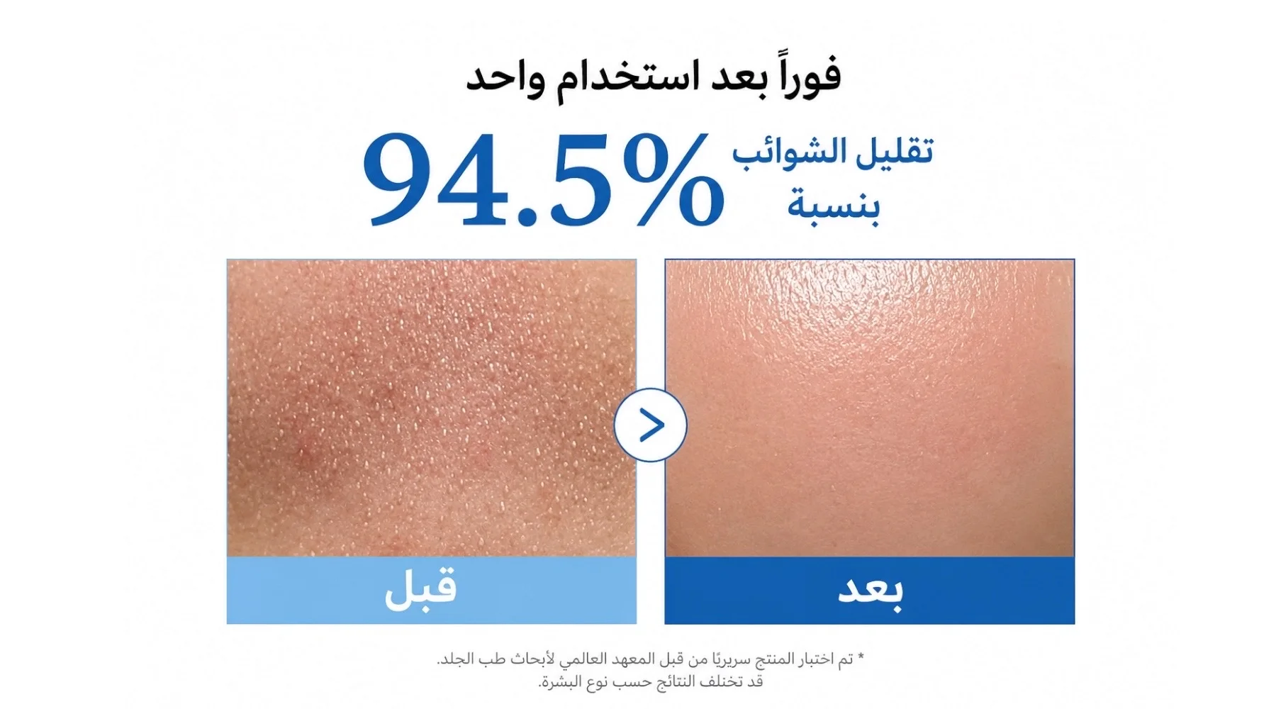 Medicube Zero Pore Cleansing Oil 205mlزيت التنظيف ميديكيوب زيرو بور 205 مل لإزالة المكياج وتنظيف البشرة بلطف لجميع أنواع البشرة