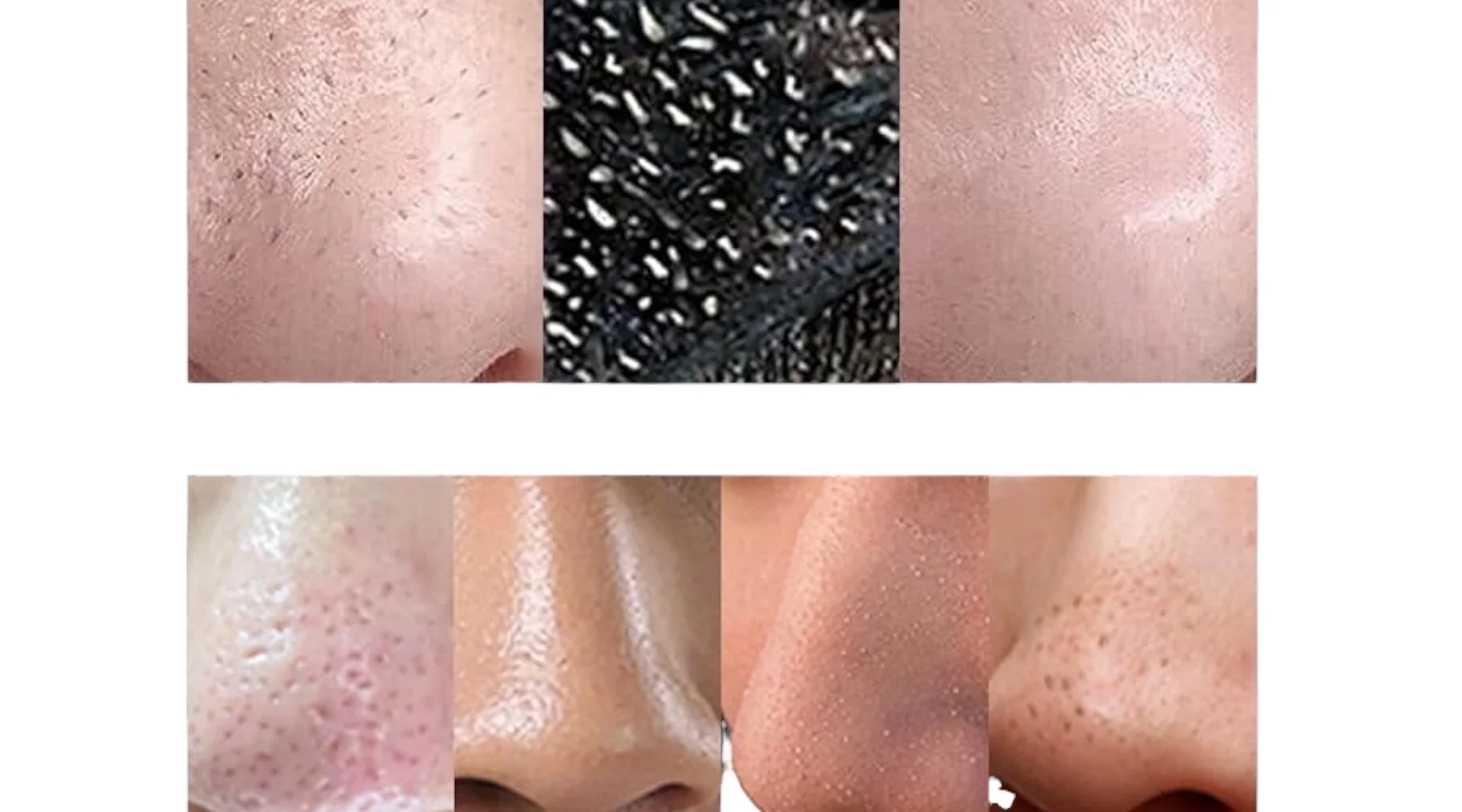 قناع ازالة الروؤس السوداء من لانبينا 30 جرام lanbena-nose-face-cleansing-mask قناع ازالة الروؤس السوداء من لانبينا 30 جرام