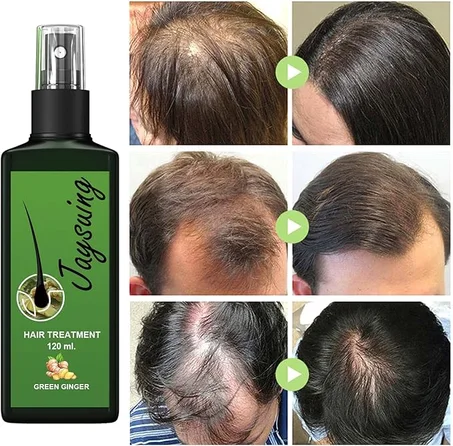 Ginger Hair Loss Spray