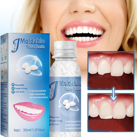 حبيبات ترميم الأسنان