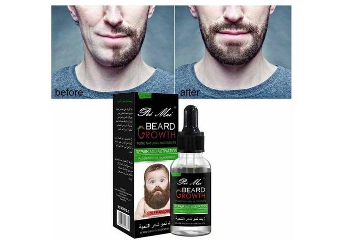stores/bd0e78040775a63ebd7cc233166d8f84/products/CnGocBgSlwLYChHXPqp5MyfXRlRF0OIXYRGy7UYD.jpg