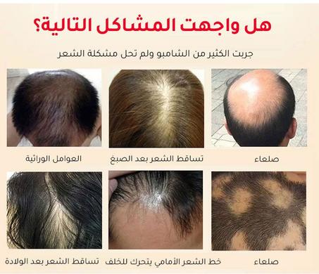 صابون عجيب لعلاج الشيب والشعر الابيض الكوري