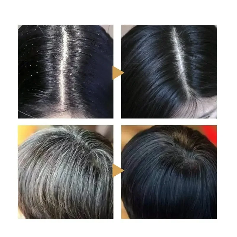Black Bright Curing Shampoo الصابون الأسود للعناية بالشعر والقشرة