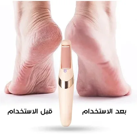 💕 جهاز تقشير القدم الالكتروني الأكثر طلبا على مستوى العالم 💕