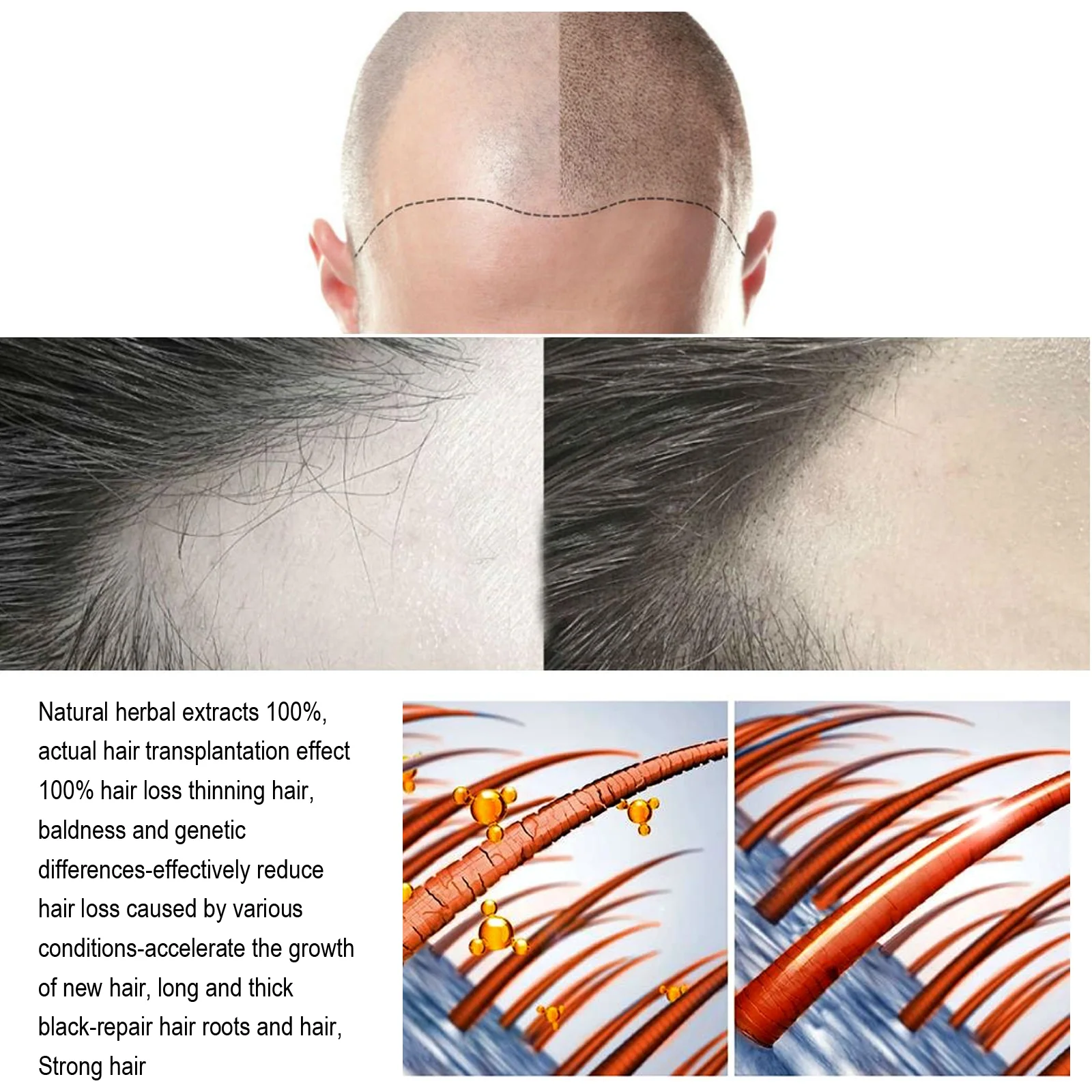 Jaysuing HAIR TREATMENT - KSA