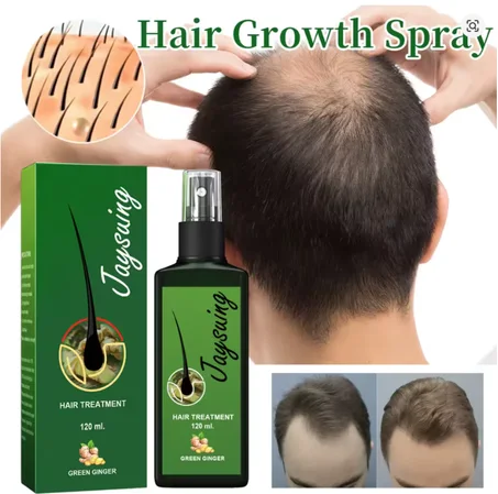 سبراي للشعر 120 مل: يقوّي جذور الشعر لتحسين تساقط الشعر وتقصفه، ويغذّي ويرطّب مع تدليك فروة الرأس، محلول مُغذٍ.