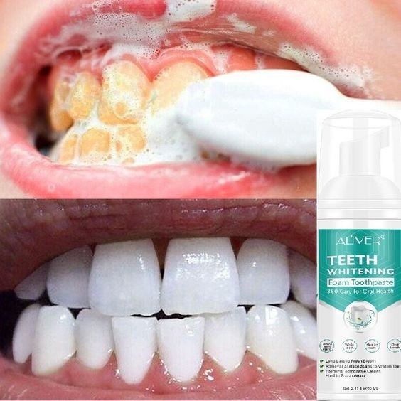 Teeth Cleaning منتتج الاسنان الرغوي
