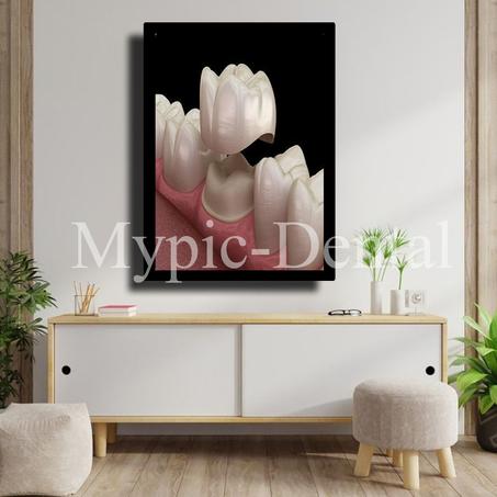 TABLEAU DÉCORATIF MODERNE POUR UN CABINET DENTAIRE