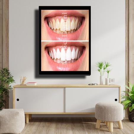 TABLEAU DÉCORATIF MODERNE POUR UN CABINET DENTAIRE