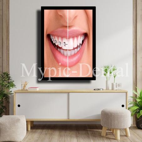 TABLEAU DÉCORATIF MODERNE POUR UN CABINET DENTAIRE