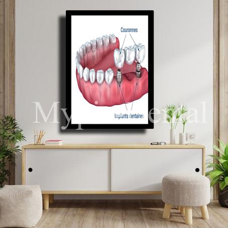 TABLEAU DÉCORATIF MODERNE POUR UN CABINET DENTAIRE